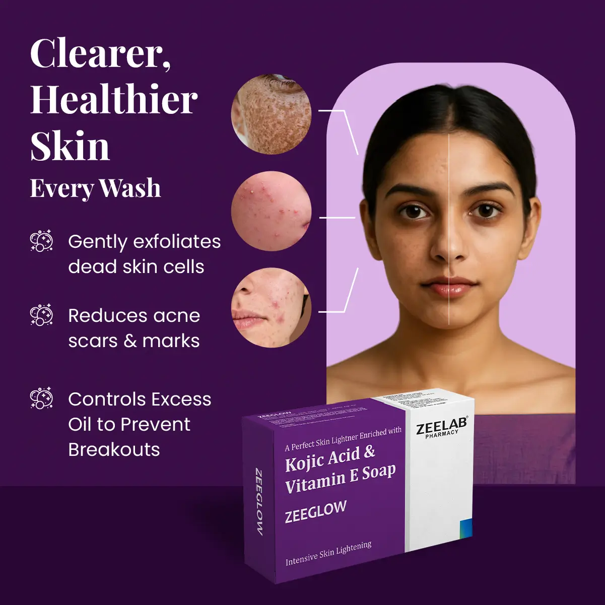 Zeeglow Kojic Acid & Vitamin E Soap | Helps Reduce Pigmentation & Uneven Tone